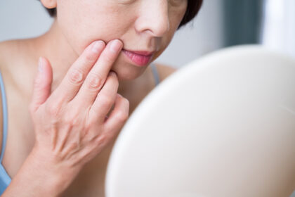 皮膚科で相談の多い症状